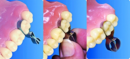 Contoured matrices (16 pcs box) for premolars - TOR VM