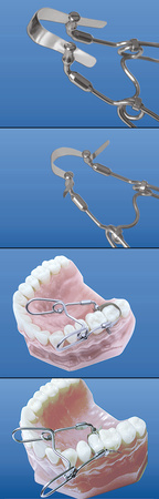 Pony slot springclip