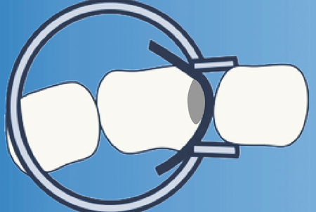 Ring for sectional matrices F-Ring - TOR VM